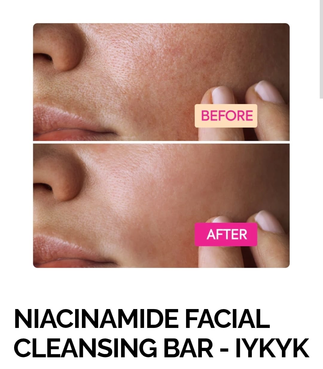 NIACINAMIDE FACIAL CLEANSING BAR - IYKYK