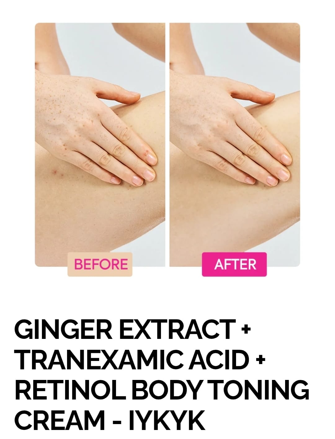 GINGER EXTRACT + TRANEXAMIC ACID + RETINOL BODY TONING CREAM - IYKYK