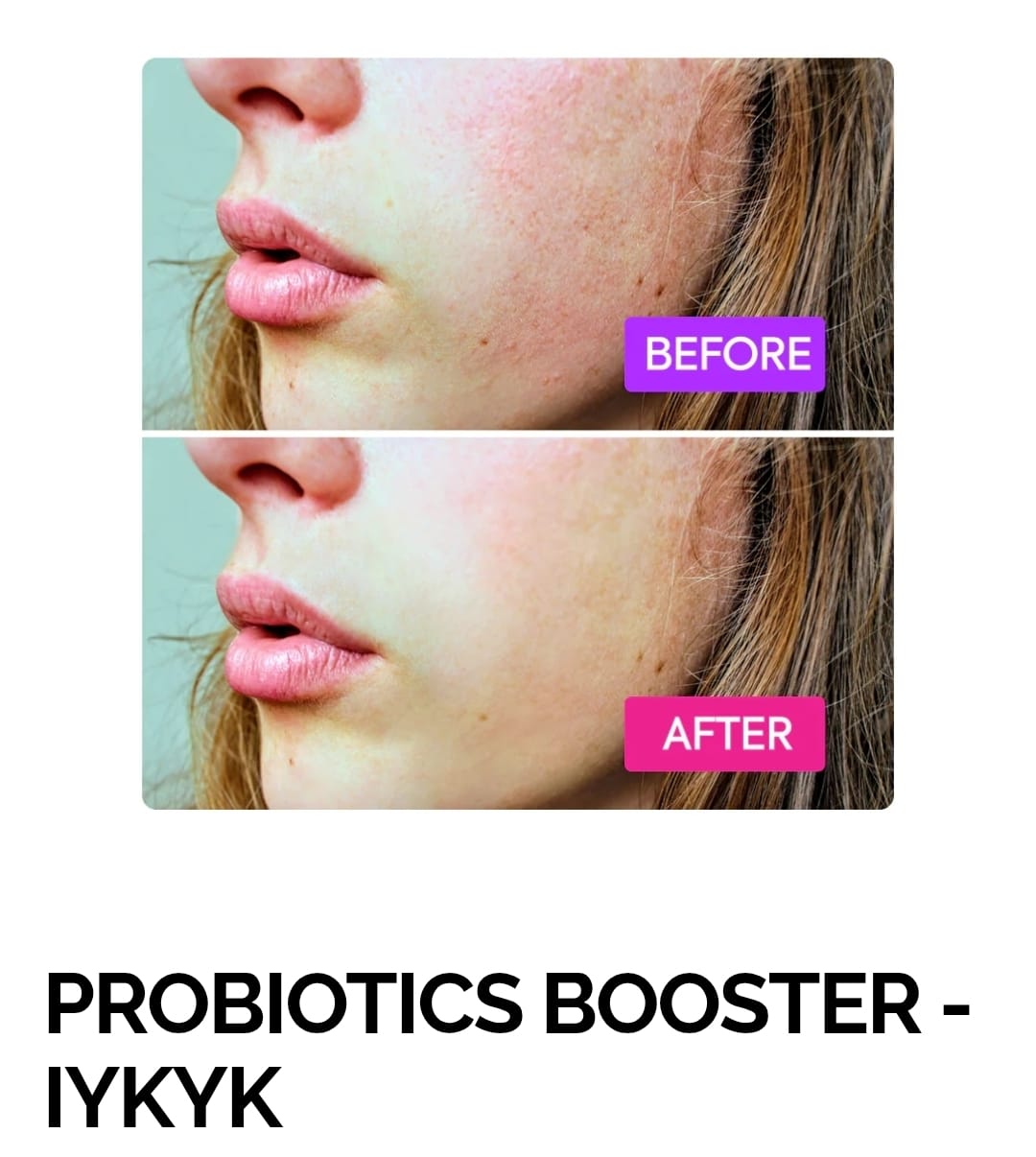 PROBIOTICS BOOSTER - IYKYK