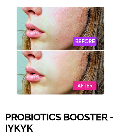 PROBIOTICS BOOSTER - IYKYK