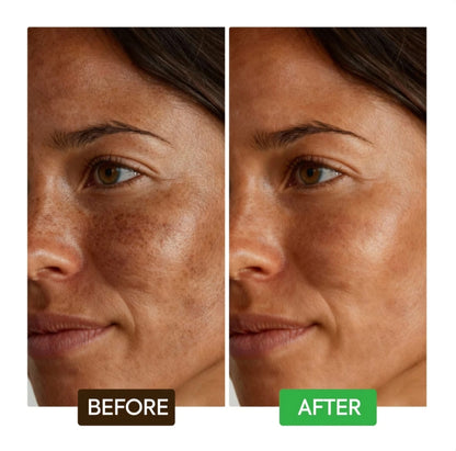 KOJIC ACID DARK SPOT REMOVER SOAP BARS