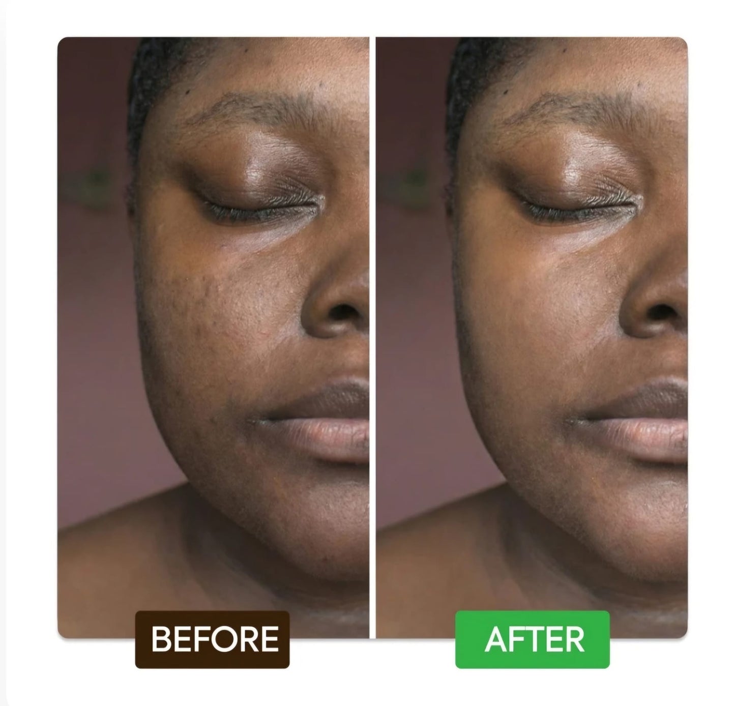 KOJIC ACID DUO KIT