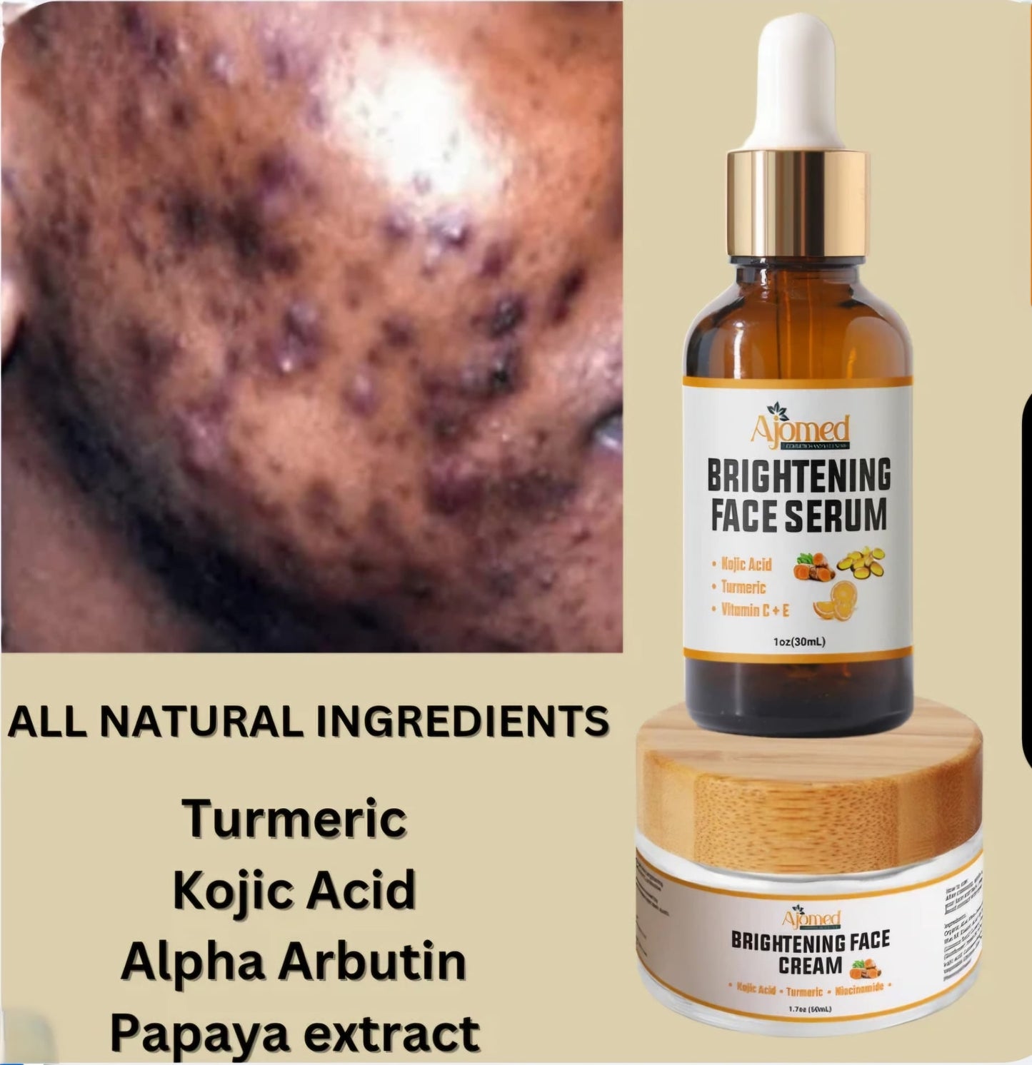 AJOMED Cosmetics and Wellness
Kojic Acid & Turmeric Brightening Neck Face Cream with Alpha Arbutin, Niacinamide and Papaya. Handmade Face cream