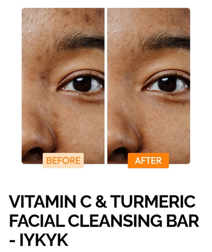 VITAMIN C & TURMERIC FACIAL CLEANSING BAR - IYKYK
